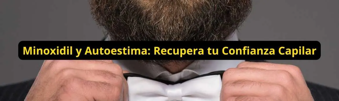 Minoxidil y autoestima recupera tu confianza capilar: guía útil