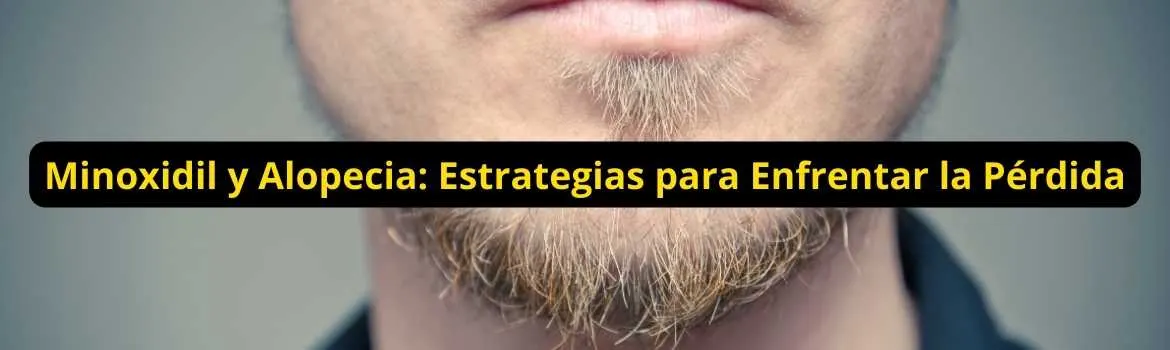 Minoxidil y alopecia estrategias para enfrentar la pérdida: actuar temprano sin comprar por pánico