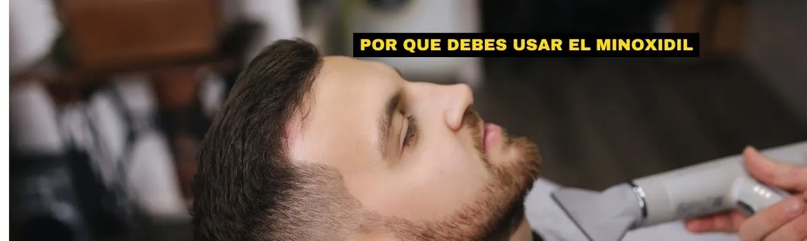 Minoxidil si funciona: explicado sin vueltas: lo que revisaría antes de empezar