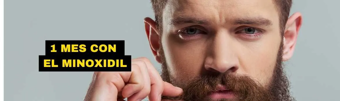 Qué pasa si solo uso un mes minoxidil para la barba obtendre increibles resultados: guía útil: caso 2