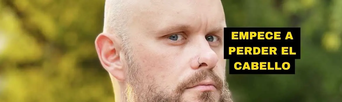 Empece a perder cabello a los 14 anos history time: actuar temprano sin comprar por pánico