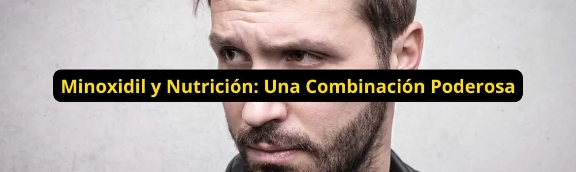 Minoxidil y nutricion una combinacion poderosa: guía útil
