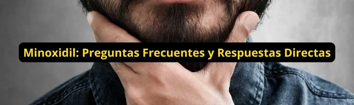 Minoxidil preguntas frecuentes y respuestas directas: guía útil