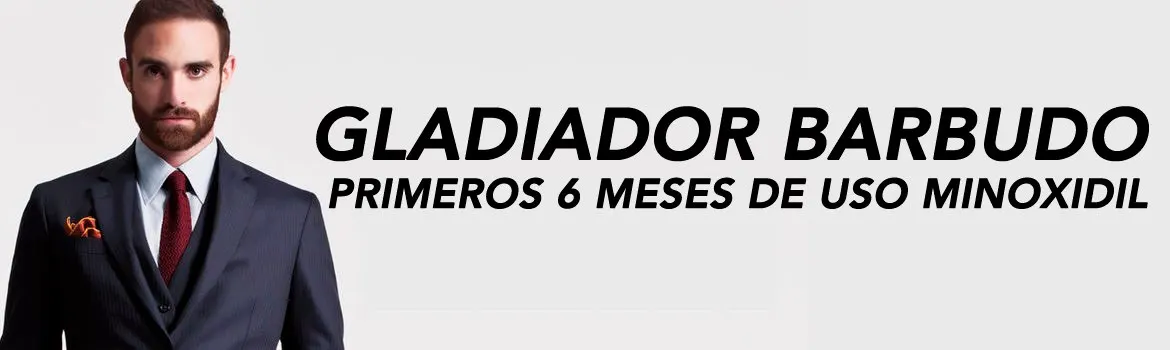 Dale 6 meses a minoxidil para funcionar: Kirkland original: señales para comprar con más confianza