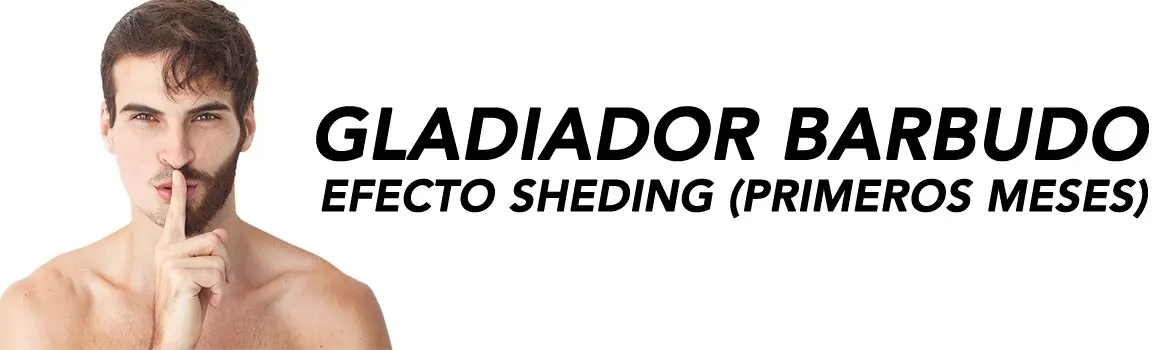 Minoxidil primeros meses la etapa shedding: explicado sin vueltas: lo que revisaría antes de empezar